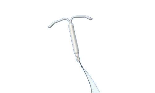 Birth control IUD in New York abortion clinic in White Plains and Queens, NY.